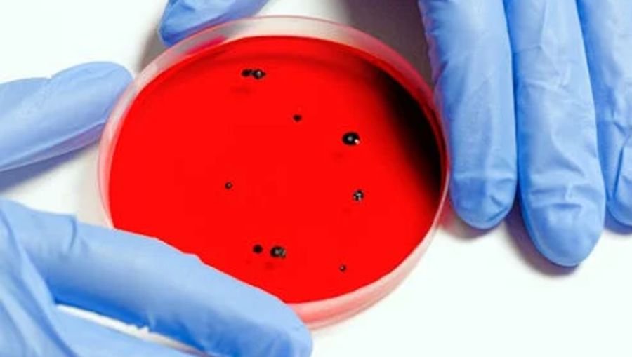 Virus Hanta Terkonfirmasi ada di RI, Kenali Gejalanya..